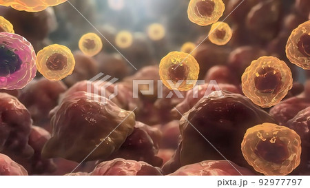 3D illustration Immune Cells Destroy Cancer Cellsのイラスト素材 [92977797] - PIXTA
