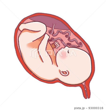 お腹の中の赤ちゃんとへその緒 お腹の中の赤ちゃんとへその緒 93000316