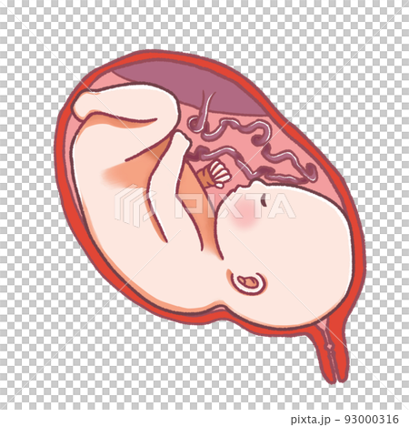 お腹の中の赤ちゃんとへその緒 お腹の中の赤ちゃんとへその緒 93000316
