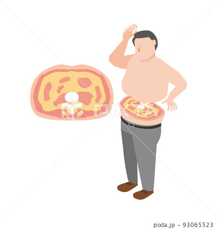 内臓脂肪に悩む中年男性 内臓脂肪に悩む中年男性 93065523