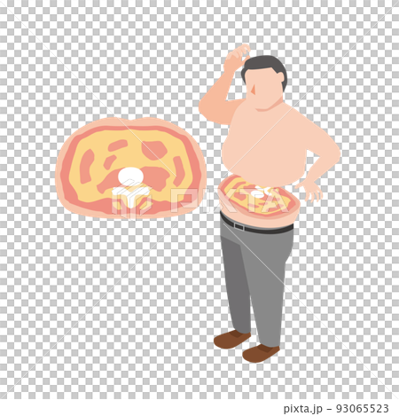 内臓脂肪に悩む中年男性 内臓脂肪に悩む中年男性 93065523