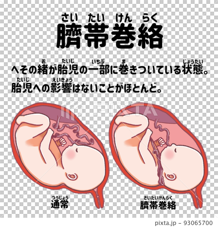 簡單易懂的臍帶纏繞日語圖解：人體解剖圖 93065700
