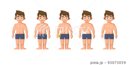 Inflammation and Removal Appendix Icons Set. Vector Inflammation and Removal Appendix Icons Set. Vector 93073059