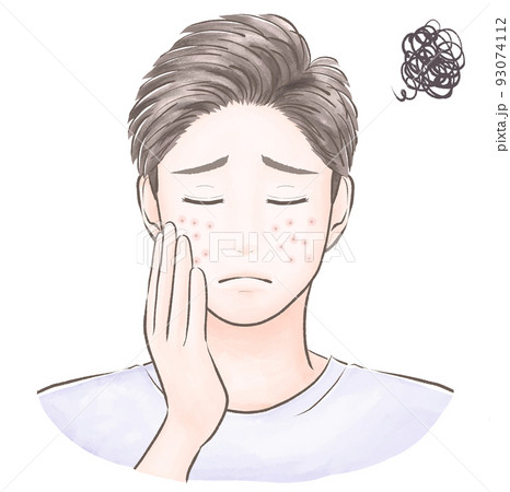 肌荒れに悩む短髪の男性 閉眼 水彩風 肌荒れに悩む短髪の男性 閉眼 水彩風 93074112