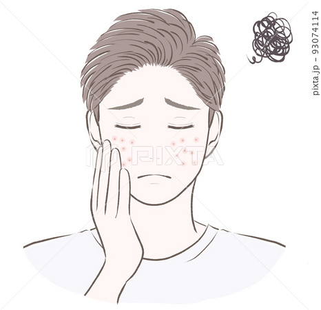 肌荒れに悩む短髪の男性 閉眼 肌荒れに悩む短髪の男性 閉眼 93074114