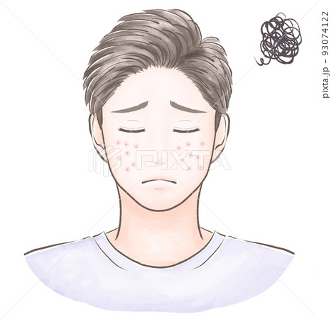 肌荒れに困っている短髪の男性 閉眼 水彩風 肌荒れに困っている短髪の男性 閉眼 水彩風 93074122