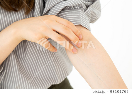 腕をかくアトピーの若い女性 93101765