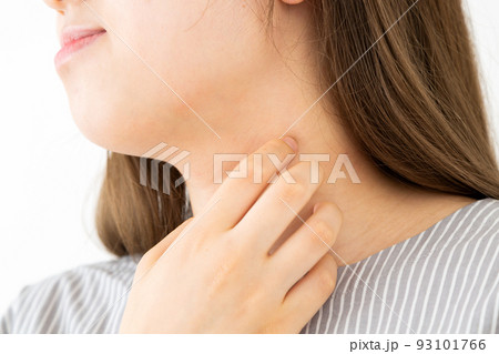首をかくアトピーの若い女性 93101766