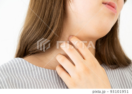 首をかくアトピーの若い女性 93101951