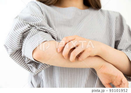 腕をかくアトピーの若い女性 93101952