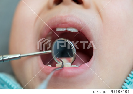 8 years old 93108501