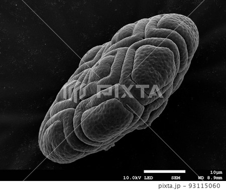 ミモザの花粉を電子顕微鏡で見ると ミモザの花粉を電子顕微鏡で見ると 93115060