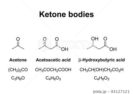 Ketone bodies, chemical formulas. Water-soluble molecules, that contain ketone groups, produced from fatty acids by the liver by ketogenesis. Acetone, Acetoacetic acid, and beta-Hydroxybutyric acid. Ketone bodies, chemical formulas. Water-soluble molecules, that contain ketone groups, produced from fatty acids by the liver by ketogenesis. Acetone, Acetoacetic acid, and beta-Hydroxybutyric acid. 93127121
