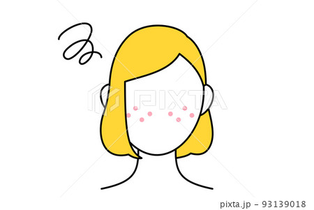 美容、女性のスキンケアのイメージ、ニキビ肌に悩む女性 93139018