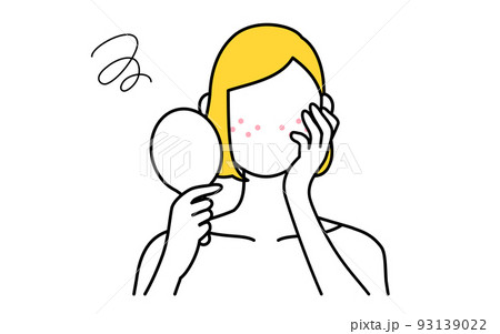 美容、女性のスキンケアのイメージ、ニキビ肌に悩む女性 93139022