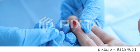 Doctor takes blood sample of patient serological test for PRP blood antibodies 93184651