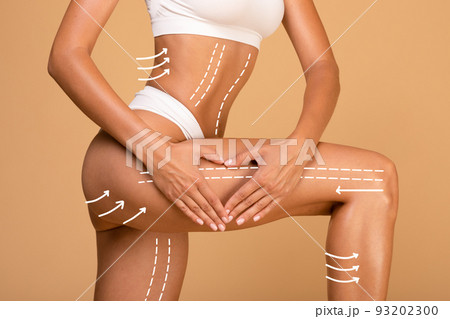 Lifting and anti-age concept. Young woman with massage lines and arrows on her body touching skin on leg Lifting and anti-age concept. Young woman with massage lines and arrows on her body touching skin on leg 93202300