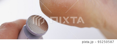 Callus peeling using professional pedicure drill machine. spa foot treatment Callus peeling using professional pedicure drill machine. spa foot treatment 93250587