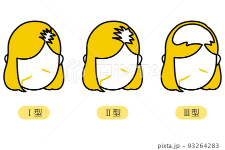 女性のAGA・薄毛、ルードヴィヒ分類Ⅰ型、Ⅱ型、Ⅲ型 女性のAGA・薄毛、ルードヴィヒ分類Ⅰ型、Ⅱ型、Ⅲ型 93264283