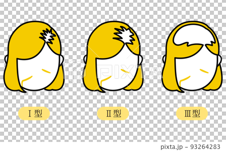 女性 AGA,頭髮稀疏,路德維希分類 I 型,II 型,III 型 女性 AGA,頭髮稀疏,路德維希分類 I 型,II 型,III 型 93264283