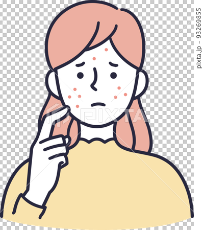 一個患有痤瘡的女人簡單的插圖 93269855