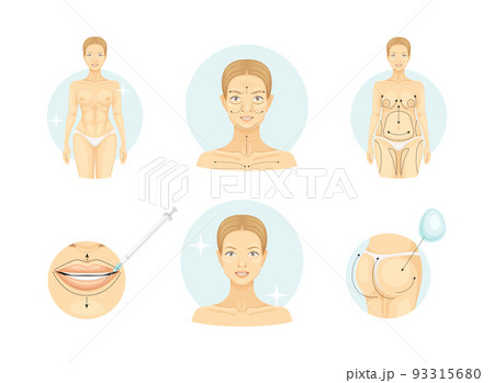 Plastic Surgery as Restoration and Reconstruction of Human Body Part in Circle Vector Set 93315680