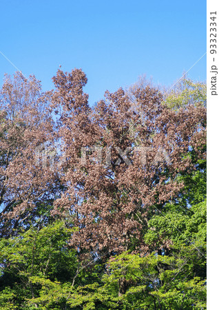 ナラ枯れで枯れてしまった樹木と被害を受けていない青々とした樹木 93323341