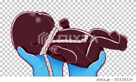 出産の瞬間のイラスト へその緒が巻きついている赤ちゃん 出産の瞬間のイラスト へその緒が巻きついている赤ちゃん 93329324