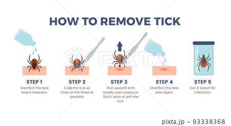 How to remove tick infographics banner, flat vector illustration on white background. How to remove tick infographics banner, flat vector illustration on white background. 93338368