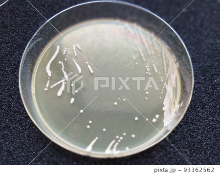 酵母菌の生えたシャーレ 酵母菌の生えたシャーレ 93362562