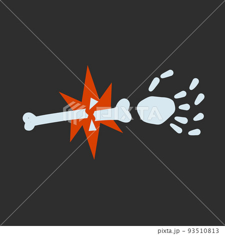Sick hand. Broken bone. Flat cartoon illustration. - Stock Illustration  [93510813] - PIXTA