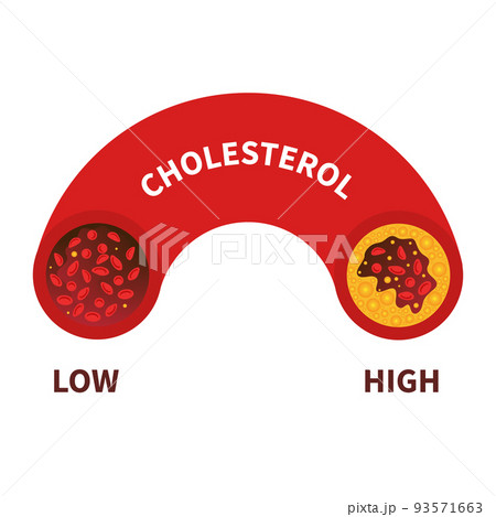 Cholesterol level meter gauge with blood vessel diagram Cholesterol level meter gauge with blood vessel diagram 93571663