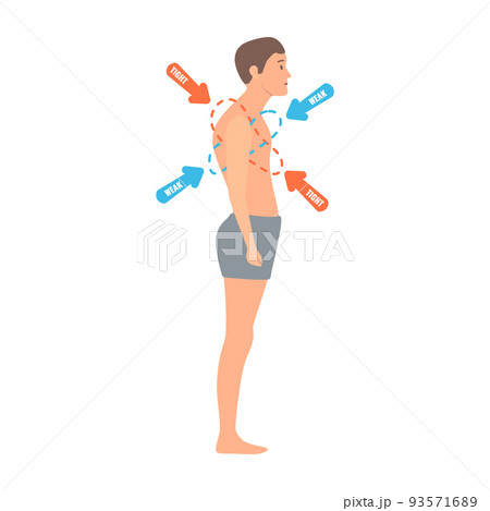 Crooked man with upper crossed syndrome imbalance Crooked man with upper crossed syndrome imbalance 93571689