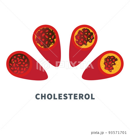 Cholesterol level meter gauge with blood vessel diagram 93571701