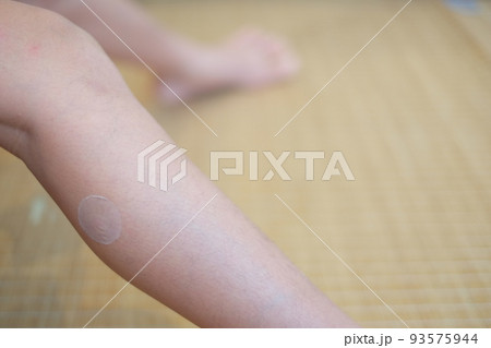 貼るかゆみ止め 貼るかゆみ止め 93575944
