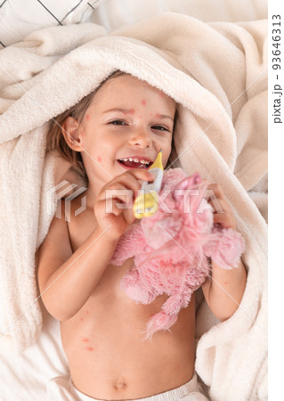 Child with chicken pox lying in bed with Thermomete Child with chicken pox lying in bed with Thermomete 93646313