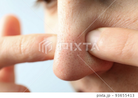 Concept of skin care with nose with dots Concept of skin care with nose with dots 93655413