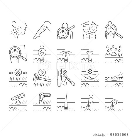 Ingrown Hair Problem Treatment Icons Set Vector Ingrown Hair Problem Treatment Icons Set Vector 93655663