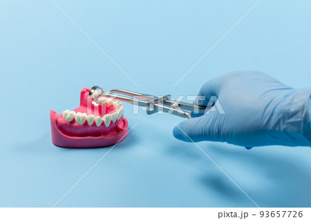 Dentist in gloves with rubber dam clamp forceps. 93657726