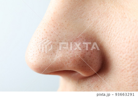 Concept of skin care with nose with dots 93663291