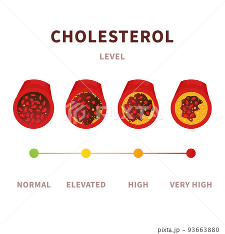 Cholesterol level meter gauge with blood vessel diagram 93663880