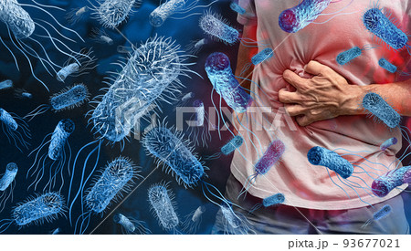 Salmonella Poisoning 93677021