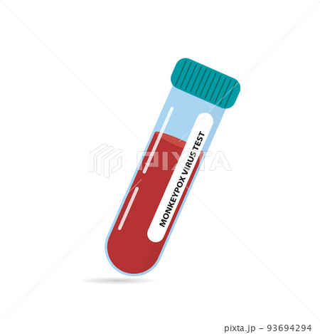 A test tube with a blood sample for testing for monkeypox virus and viral cells. Microbiological medical data.Vector illustration 93694294