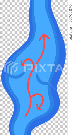 静脈瘤 静脈瘤 93703870