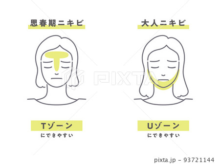 思春期ニキビと大人ニキビ 93721144