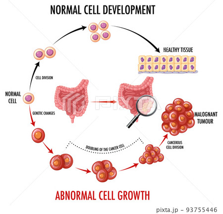 Diagram showing normal cell development 93755446