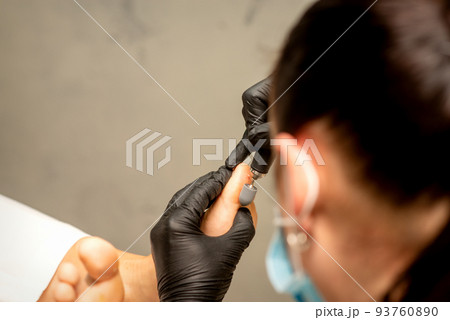 Podiatrist wearing black protective gloves cleaning the skin of foot from callus and corn with the professional electric tool 93760890