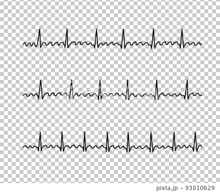 Atrial flutter (AFL) - Stock Illustration [93810629] - PIXTA