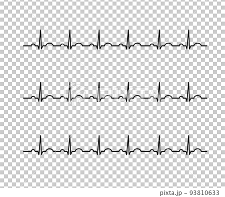 electro-cardiogram electro-cardiogram 93810633