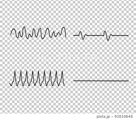 lethal arrhythmia 93810648